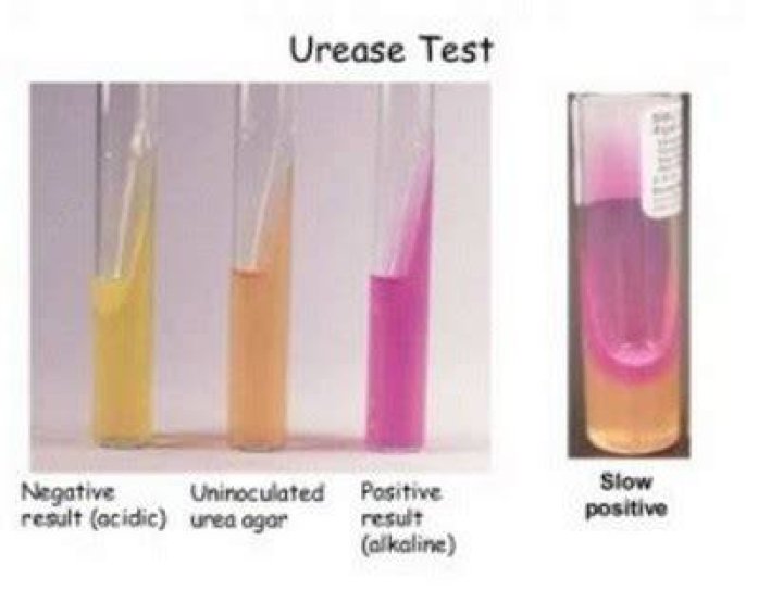 What does a positive urease test look like