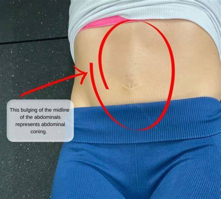 What does abdominal girth mean