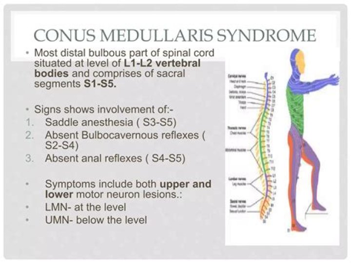 What does Conus Medullaris do