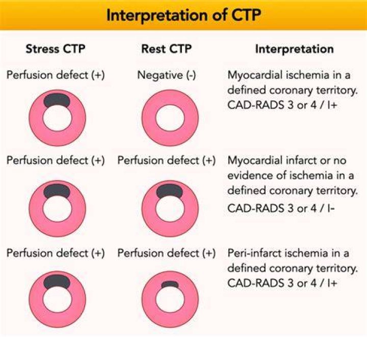 What does CTP designation mean