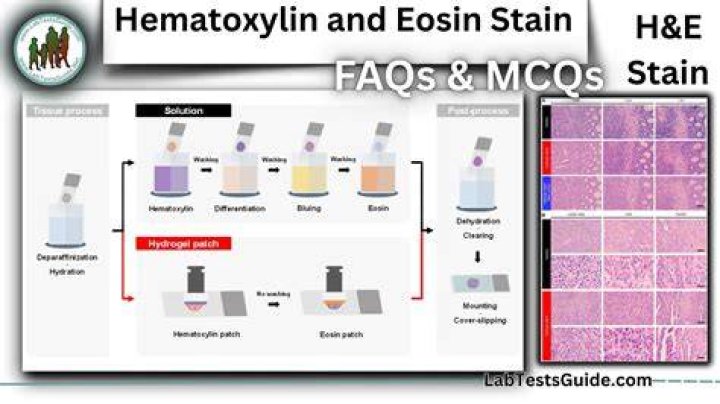 What does hematoxylin and eosin stain