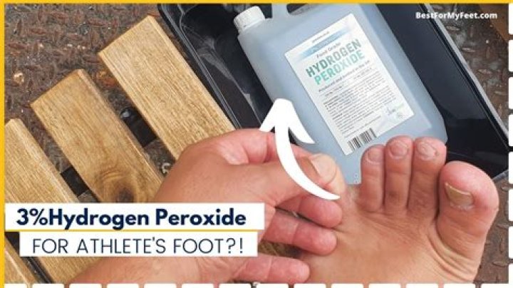 What does hydrogen peroxide do to wood