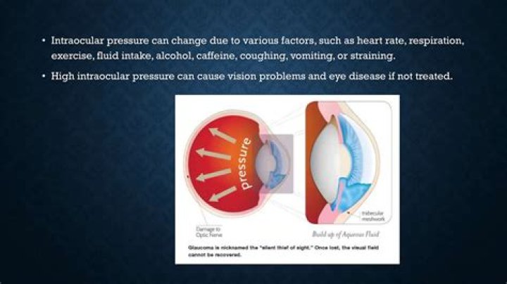 What does intraocular pressure measure