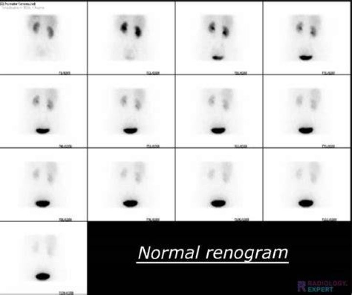 What does Renogram mean