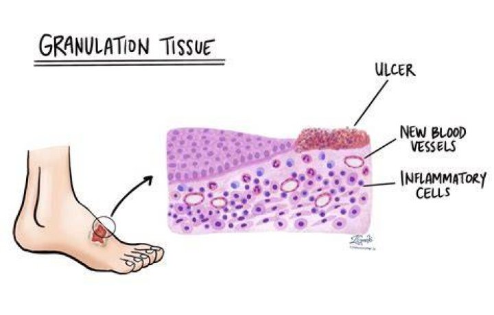 What does slight toxic granulation mean