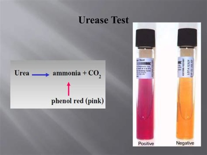 What does urease positive mean