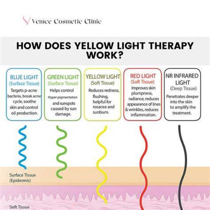 What does yellow light mean on Dyson