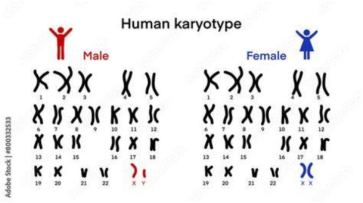 What is a normal karyotype