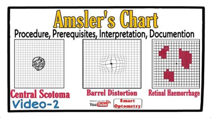 What is Amsler recording chart
