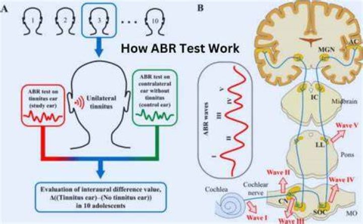 What is an ABR test for hearing