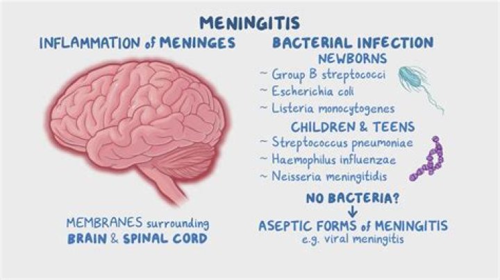 What is bacterial meningitis