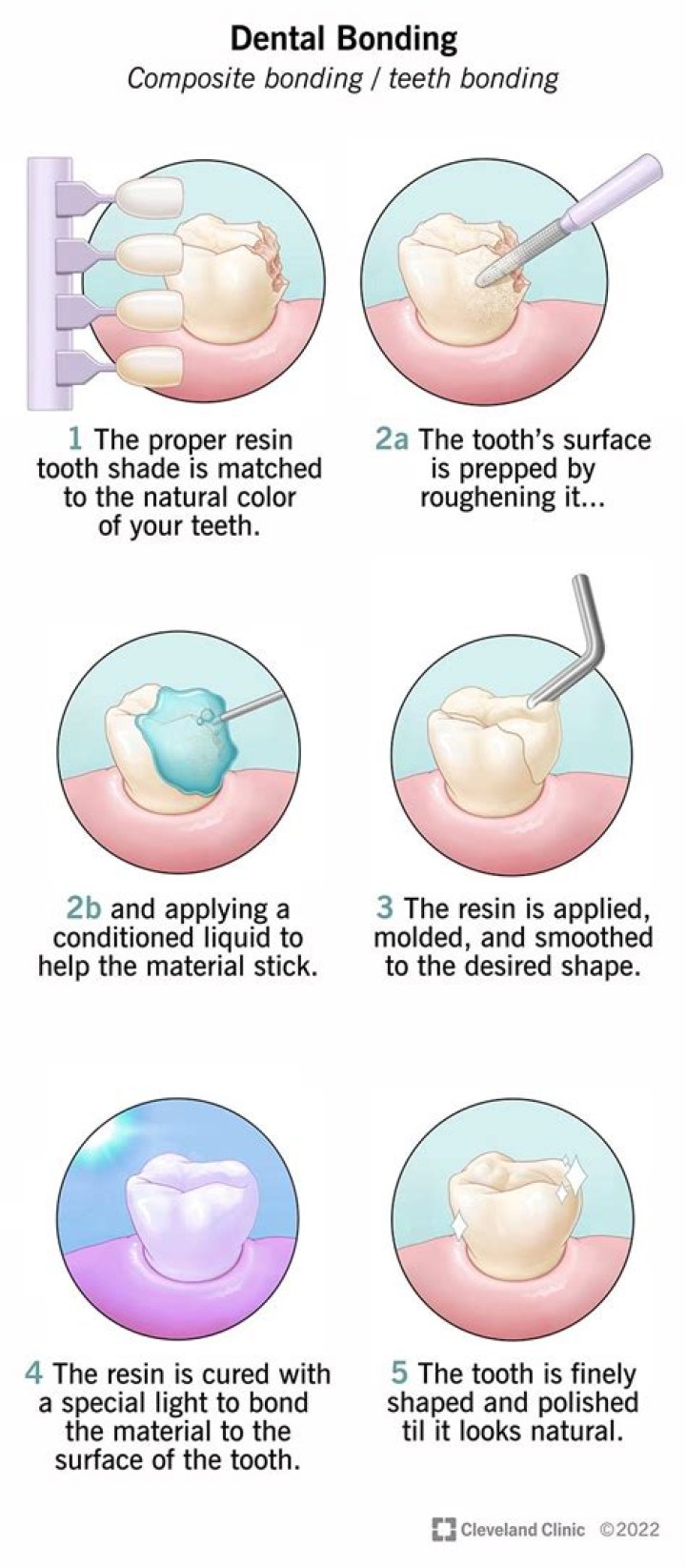 What is bonding used for
