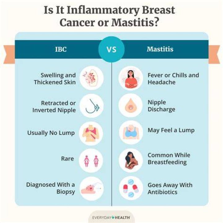 What is breast Mastalgia