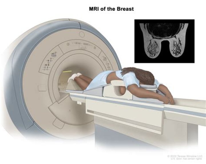 What is BSGI Breast Imaging