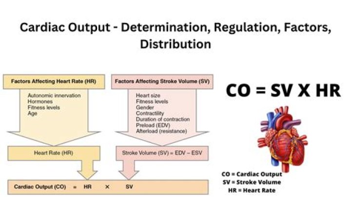 What is cardiac PCU
