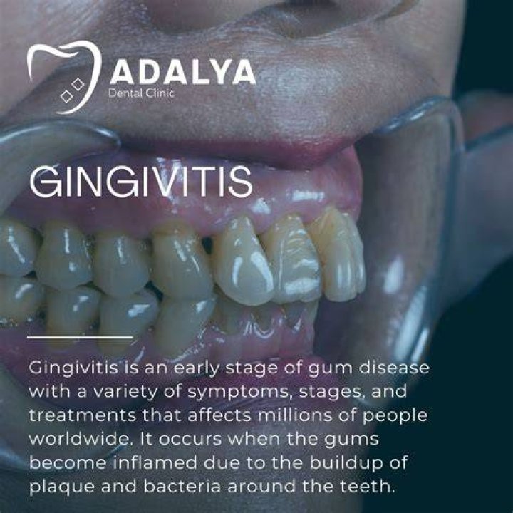 What is chronic Generalised gingivitis