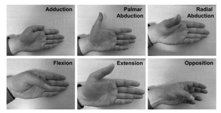What is palmar abduction