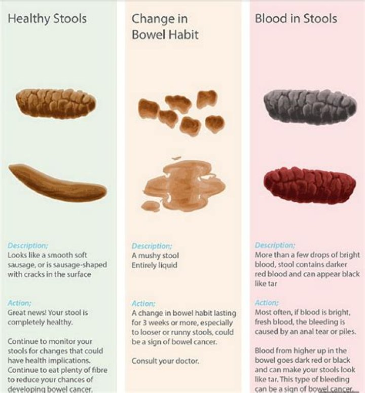What is poo poo