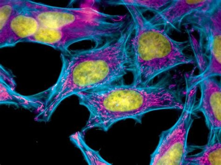 What is special about HeLa cells