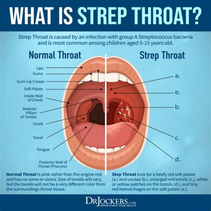What is the CPT code for strep throat