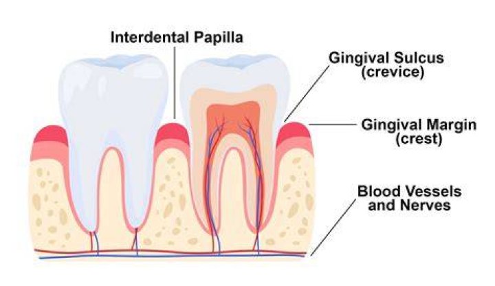 What is the gingival index