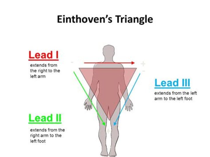 What leads Makeup The einthovens triangle