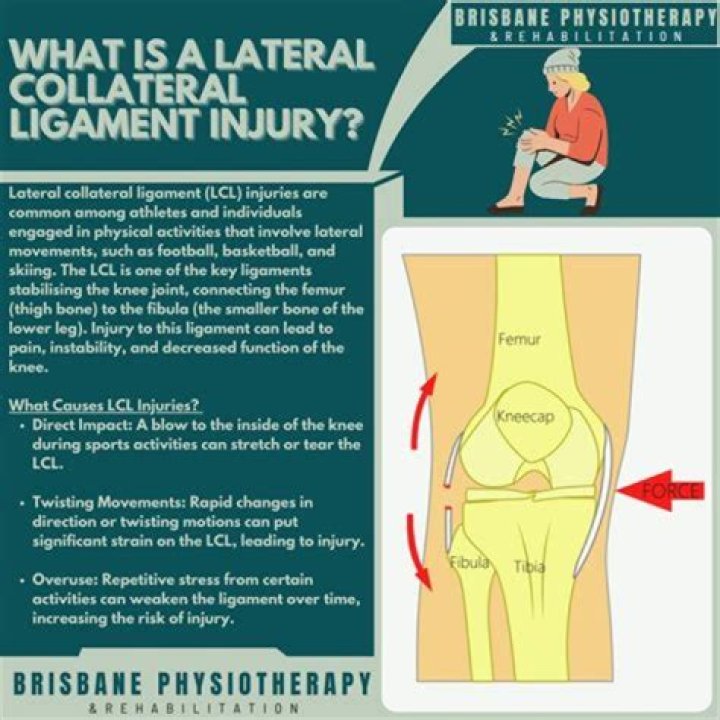 What movement does the lateral collateral ligament prevent