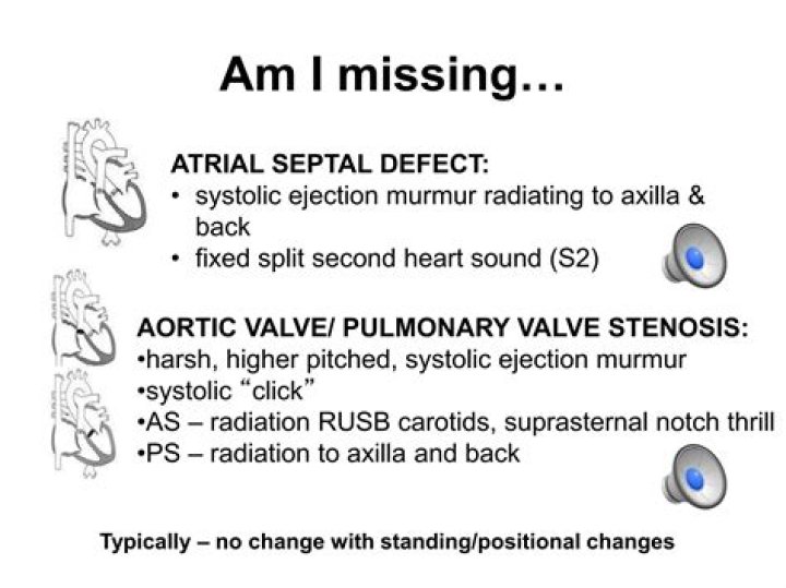 What murmur radiates to the back