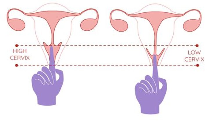 What size is your cervix
