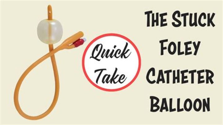 When should Bakri balloon be removed