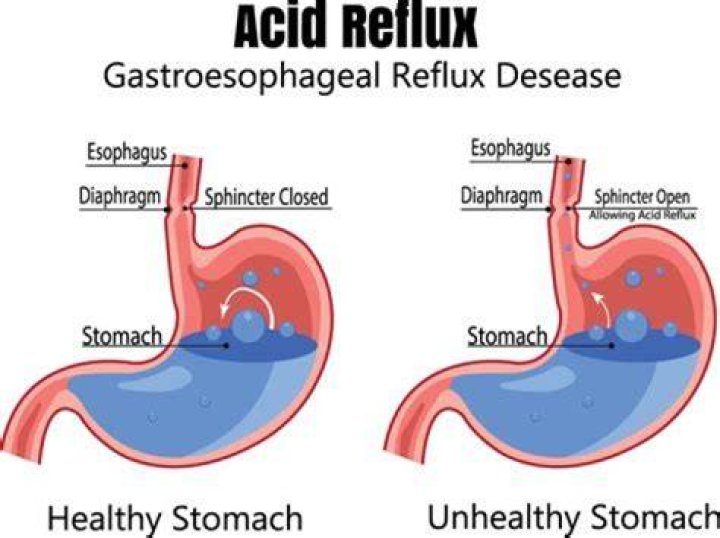 Where does ellagic acid come from