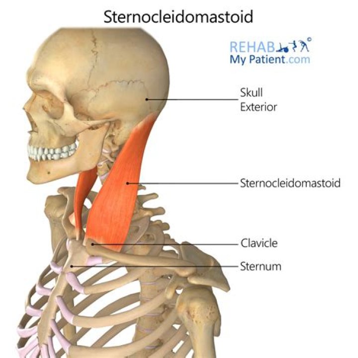 Where does the Sternocleidomastoid attach