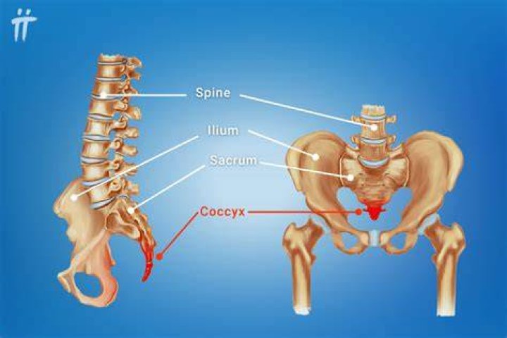 Where is a coccyx wound
