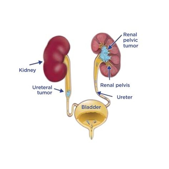 Where is urothelial located