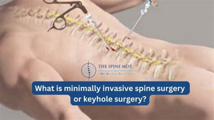 Who invented keyhole surgery