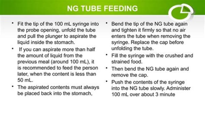 Why do we use NG model