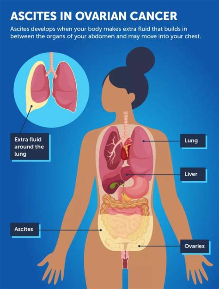 Why is ascites fluid red