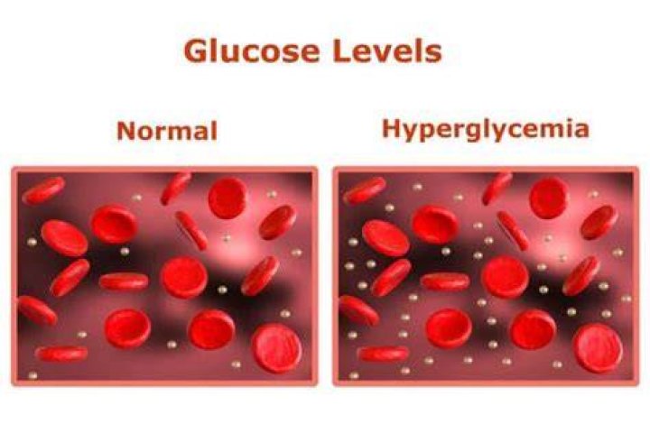 Why is hyperglycemia bad