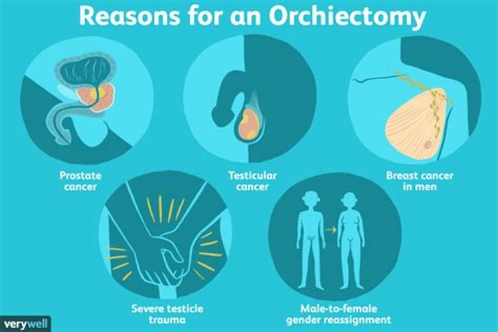 Why is orchiectomy done