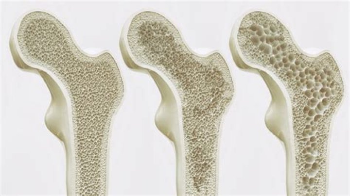 Why is the pelvis often the first bone forensic